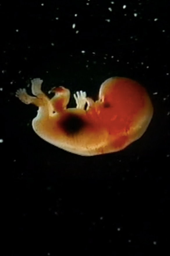 Pro-Life